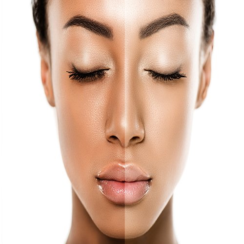 راه‌کارهایی ساده برای داشتن پوستی شفاف